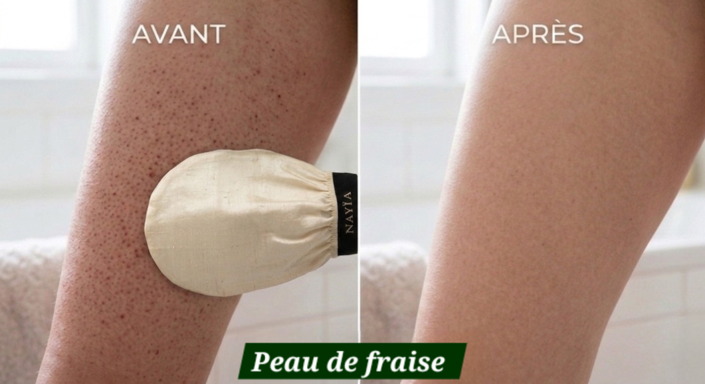 peau de fraise